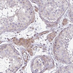 ZNF193 Antibody, Novus Biologicals 25 &mu;L, Unlabeled:Antibodies, Polyclonal